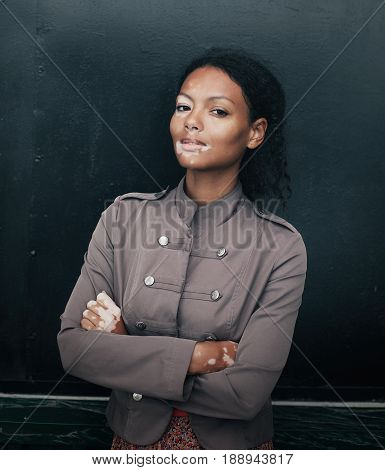 beautiful young brunette woman with vitiligo disease on the black background