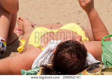Sennoy, Russia - July 18, 2017: Taman Gulf. City Beach. Woman Wearing A Bikini Sunbathing On The Bea