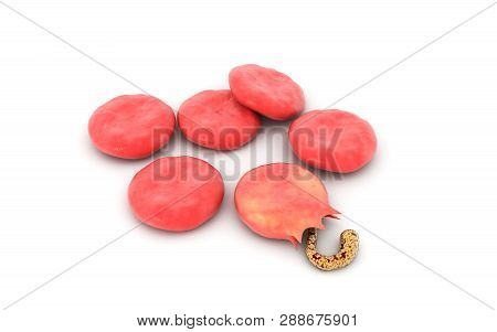 3d Rendered Malaria Virus Effect In Blood Cells On White Background