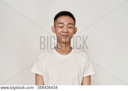 Portrait Of Young Asian Man With Problematic Skin And Hyperpigmentation On His Face Smiling With Eye