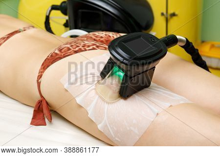 Woman Getting Cryolipolysis Fat Treatment Procedure On Hip In Beauty Salon