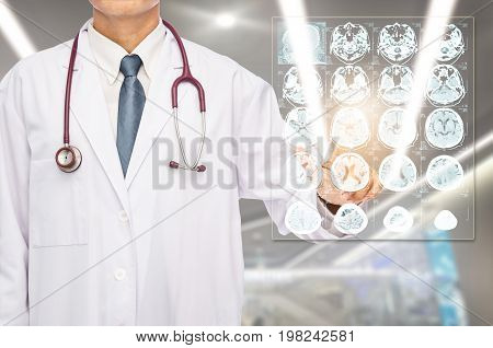 Radiologist doctor touching film brain MRI at hospital.