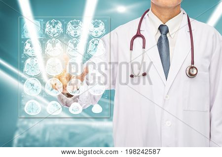 Radiologist doctor touching film brain MRI at hospital.