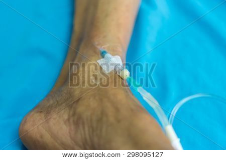 Patient With Saline Intravenous In The Hospital