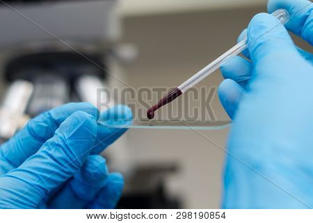 The Veterinarian Putting A Drop Of Blood On The Surface Of A Microscopic Blade