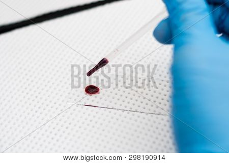 The Veterinarian Is Preparing A Blood Smear