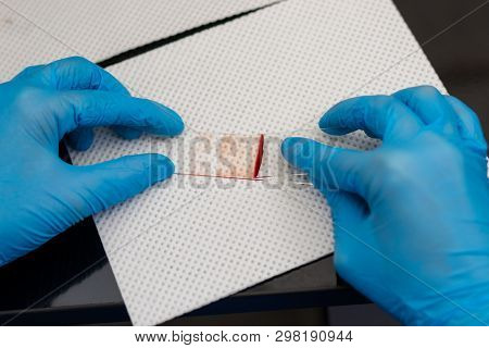 The Veterinarian Is Preparing A Blood Smear