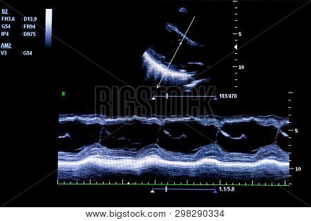 Colourful Image Of Modern Ultrasound Monitor. Ultrasonography Machine. High Technology Medical And H