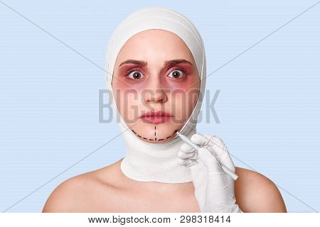 Beautiful Scared Woman With Wide Opened Eyes. Lady With Surgical Lines On Chin Wants To Corret Face.