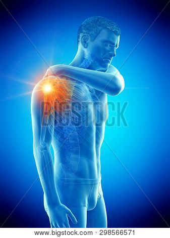 3d rendered medically accurate illustration of a man having a painful shoulder joint