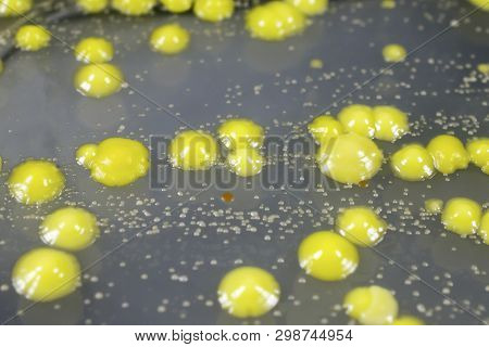 Bacteria Grown From Skin Smear, Colonies Of Micrococcus Luteus And Staphylococcus Epidermidis On Pet