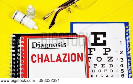 Chalazion. Text Label To Indicate The State Of Vision Health. The Diagnosis Was Made By An Ophthalmo