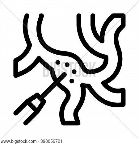 Laser Treatment Varicose Veins Black Icon Vector. Laser Treatment Varicose Veins Sign. Isolated Symb