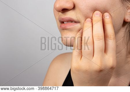 A Woman Holds A Sore Tooth With Her Hand. Dental Pain In Dentistry, Pulpitis And Tooth Decay, Nerve 