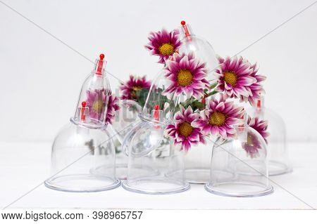 Jars For Hijama On A White Wooden Background And Pink Harezantems. Bloodletting. Sunnah Treatment. I