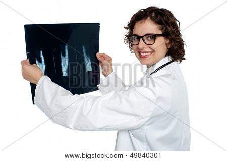 Female Doctor Reviewing X-ray Sheet Of A Patient