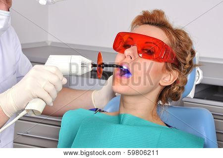 Fillings