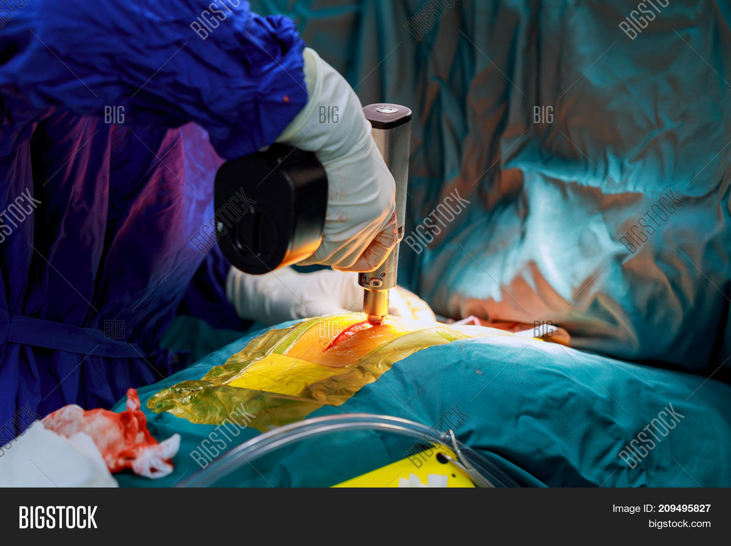 Cutting Chest During Image & Photo (Free Trial) Bigstock