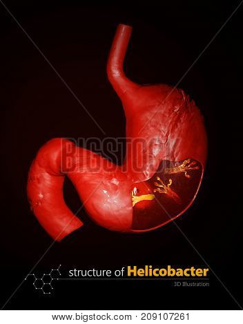 Helicobacter Pylori, Microaerophilic Bacteria Found In The Stomach. 3D Illustration.