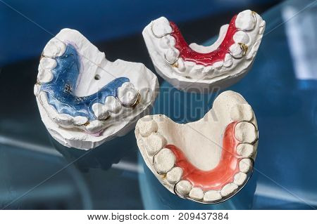 Colorful dental braces or retainers for teeth on black glass background closeup
