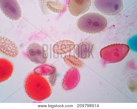 A pollen grain is a microscopic body that contains the male reproductive cell of a plant.