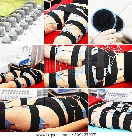 Myostimulation. Hardware cosmetology. Body care. Non surgical body sculpting. anti-cellulite and ant