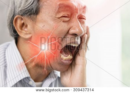 Elder Man With Severe Toothache And Hypersensitive Teeth.decayed Tooth Painful Face Expression.
