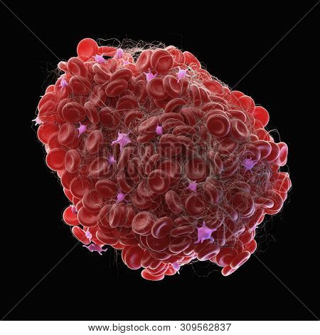 3d rendered medically accurate illustration of a blood clot