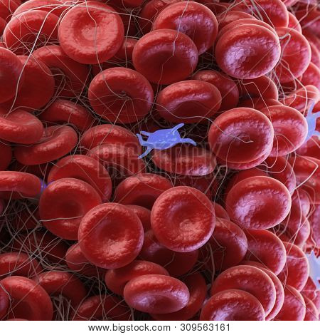 3d rendered medically accurate illustration of a blood clot