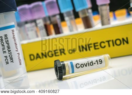 Vial With Sample Of Covid-19 Coronavirus Infected Person In A Laboratory, Conceptual Image