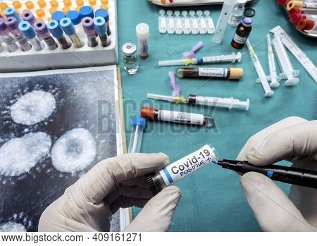 Nurse Holds Vial With Positive Result Of A Patient Infected With Covid19, Conceptual Image