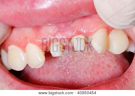 Dental Treatment