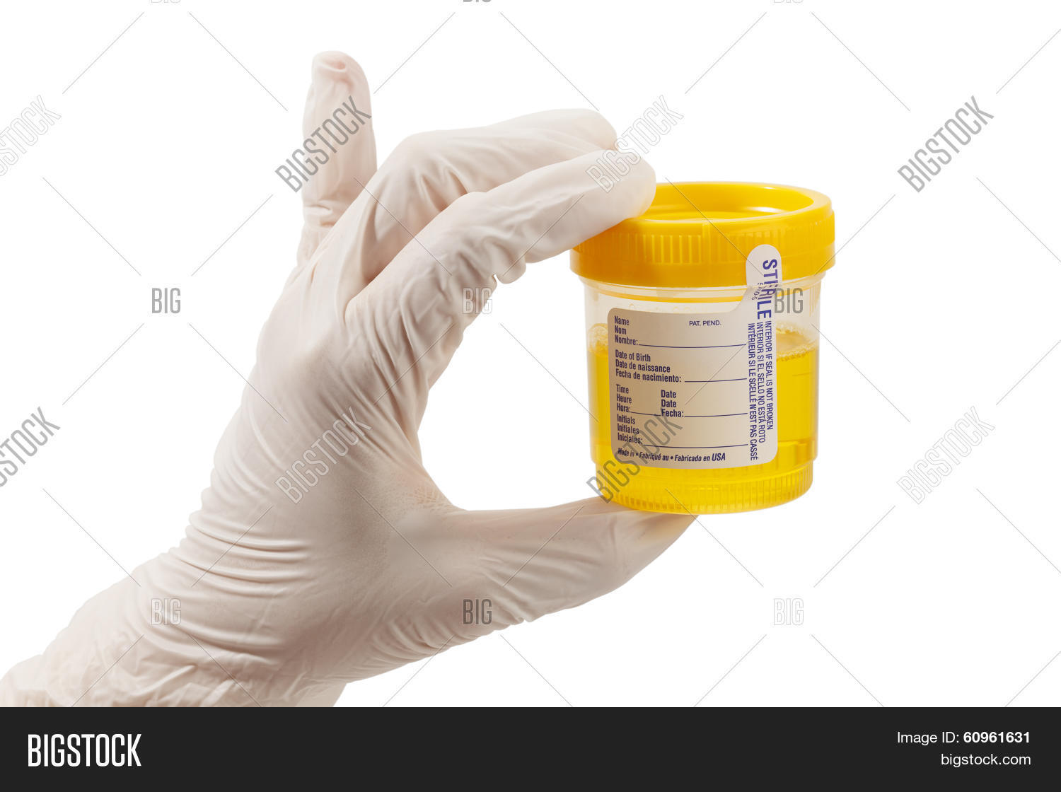 Urine Sample Glove Image & Photo (Free Trial) Bigstock