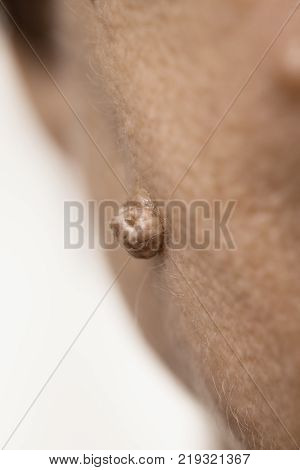 Details of senior woman face. Elderly pensioner female dermal fibroma close up.