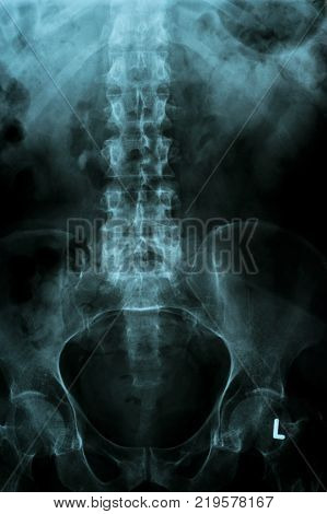 pelvis and spinal spine column X-ray image from a human body part for medical diagnosis. ideal for websites and magazines layouts