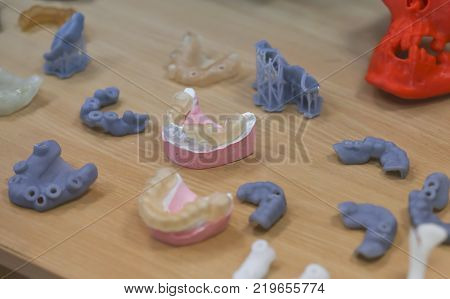 The lower jaw of a man, created on a 3d printer from a photopolymer material. Stereolithography 3D printer, technology of liquid photopolymerization under UV light. Modern medical technologies.