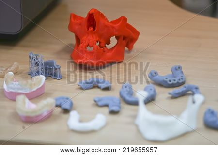 The lower jaw of a man, created on a 3d printer from a photopolymer material. Stereolithography 3D printer, technology of liquid photopolymerization under UV light. Modern medical technologies.