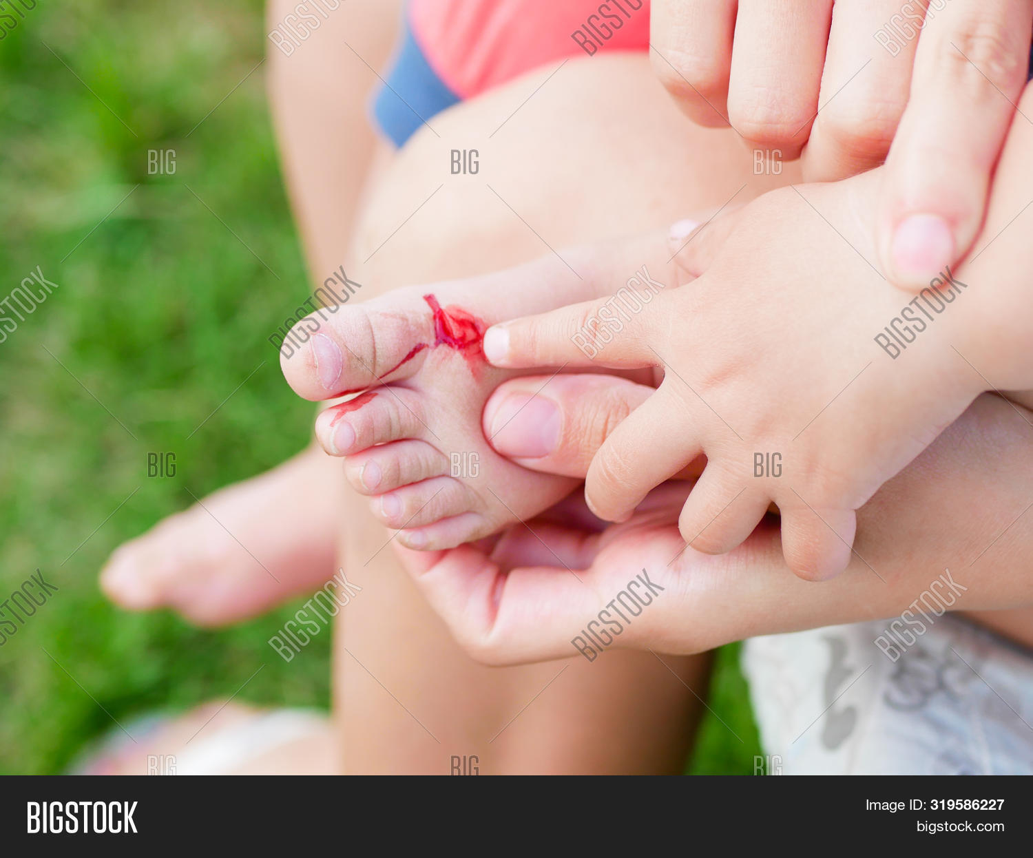 Treat Child S Wound. Image & Photo (Free Trial) Bigstock