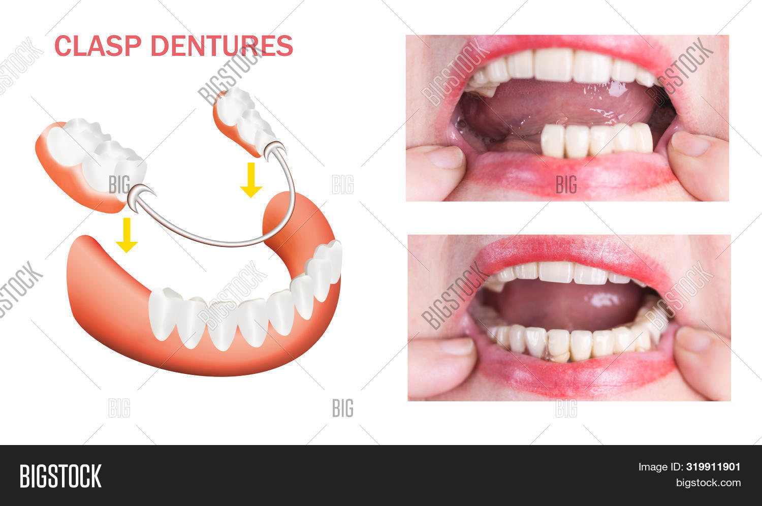 Dental Rehabilitation Image & Photo (Free Trial) Bigstock
