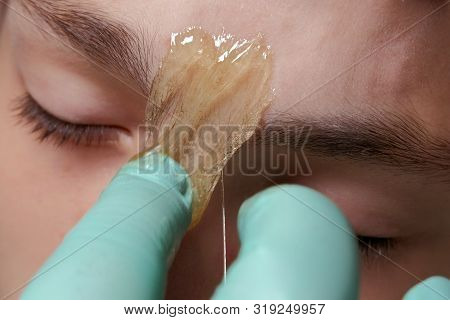 Close-up Of Part Of The Face Of A Teenager Guy. Sugaring. Epilation. A Beautician With Gloves Puts A