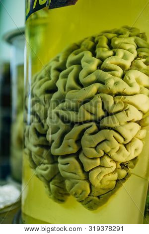 Human Brain In Glass Jar With Formaldehyde For Medical Studies