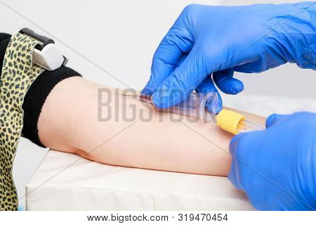 Close-up shot of doctor or nurse taking a blood sample from arm vein with a vacutainer. Venipuncture or venepuncture procedure