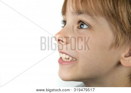 Boy's Potrtait With Problem Teeth. A Curve Row And The Wrong Bite An Occasion To Visit The Dentist A
