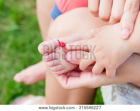 Treat A Child S Wound. Treat A Wound To A Small Child. Injured Leg Of The Child, Abrasions In The Ch