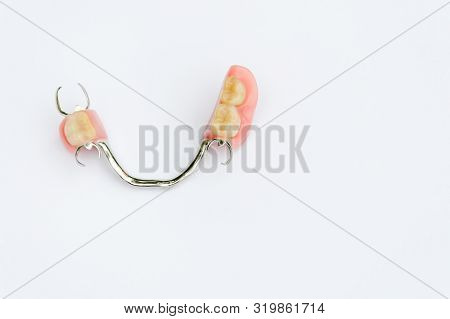 Arch Prosthesis On The Lower Jaw Without Crowns