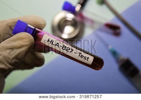 Hla-b27 - Test With Blood Sample. Top View Isolated On Office Desk. Healthcare/medical Concept
