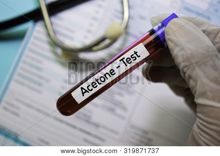 Acetone - Test With Blood Sample. Top View Isolated On Office Desk. Healthcare/medical Concept