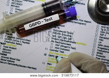 G6pd - Test With Blood Sample. Top View Isolated On Office Desk. Healthcare/medical Concept