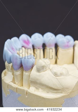 Wax gebit