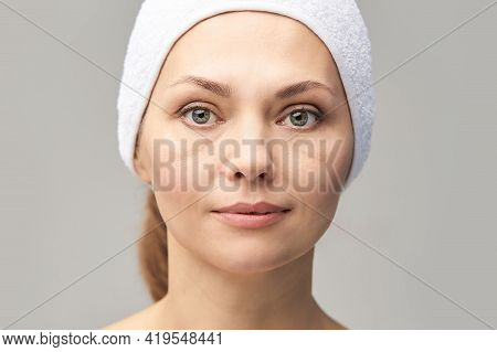 Pretty Mature Girl. Before Portrait. Anti Wrincle Healthy Therapy. Black Circle Under Eyes. Collagen